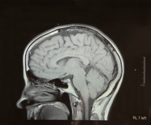 Military discontinues the use of MRI machines in combat zones